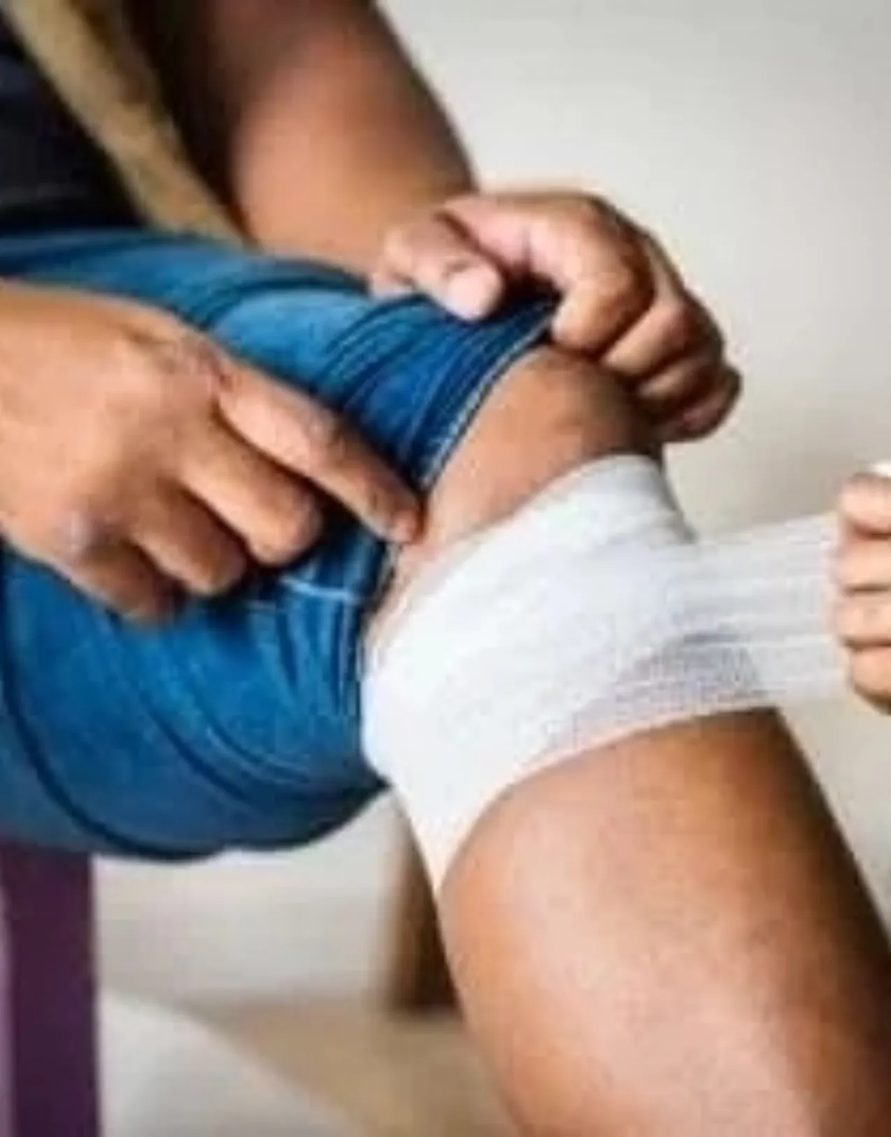 Flying with broken leg